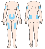 subcutaneous_prefilled_syringe-fig_1 (1).png