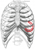 220px-Gray112.png