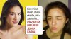 LICE-PRE-I-POSLE.jpg