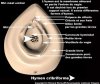 visuel-hymen-cribriforme-40f.jpg