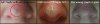 pimple-patches.jpg