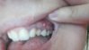 IMG_20170205_202640.jpg