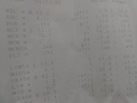 IMG_20170313_184641.jpg