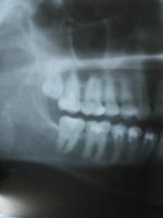 20170401_215553.jpg