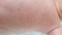 20170618_203955.jpg