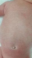 20170618_203933.jpg