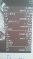 20170719_115636.jpg