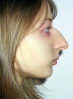 a2a9ed5f758717ed675add6fb5c1f242--big-noses-body-image.jpg