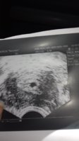 20170918_121539.jpg