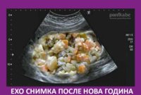 ехо.jpg