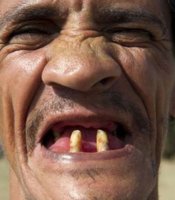 Man-With-Two-Teeth-Funny-Smiling-Closeup-Face.jpg