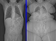 870c26577cf3b28ef8dd2929c8d23c54--x-rays-no-excuses.jpg