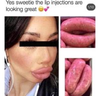 lips.jpg