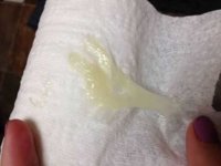 What-does-a-mucus-plug-look-like.jpg