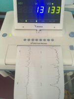 52BA0850-E843-4A3D-8503-633DCB250486.jpeg