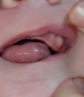 IMG_20201108_170429.jpg