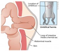 Cat_Umbilical_hernia_2020-01.jpg