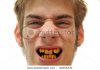 stock-photo-ugly-man-showing-off-crooked-yellow-teeth-40254331.jpg