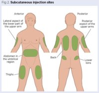 fig-2-subcutaneous-injection-sites_660.jpg