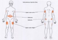 subcutaneous-injection-sites-002.jpg