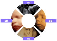 ultrasound-types.png