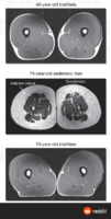 interesting-image-comparing-muscle-mass-of-young-athletes-v0-i7bbho1b2xb91.png